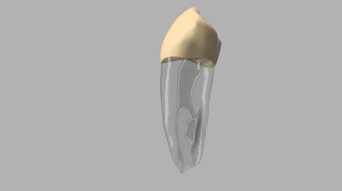 Detale kanałów zęba #28